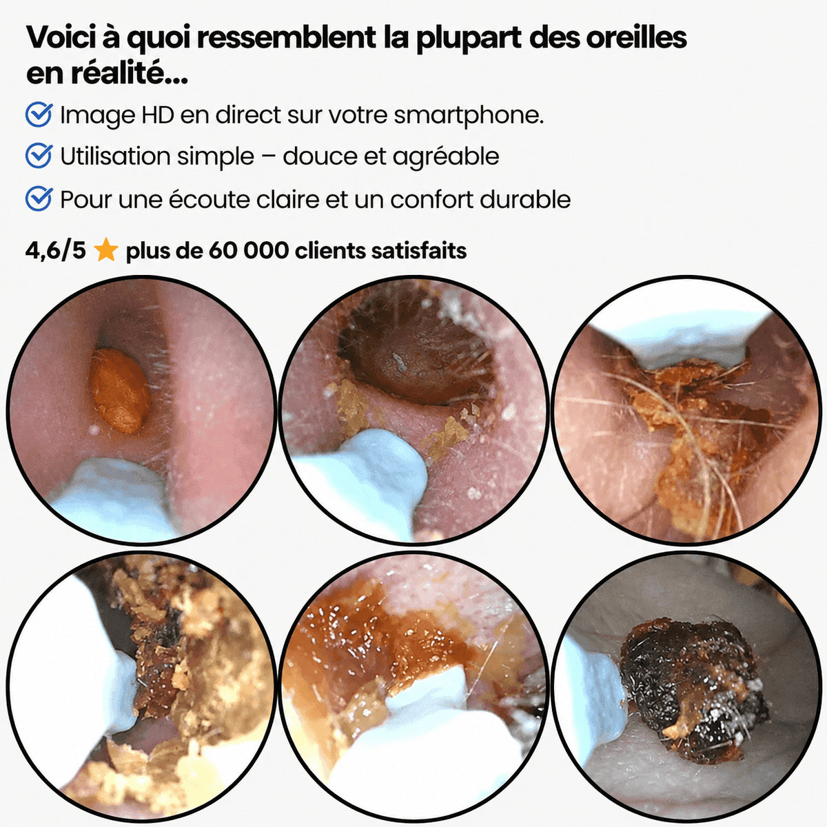HONERIS™ PRO – Nettoyeur d’oreilles visuel